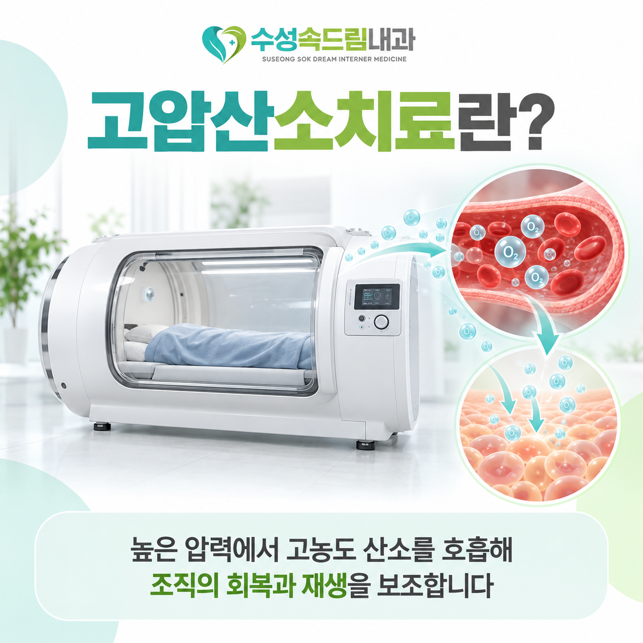 고압산소치료의 원리와 치료 계획